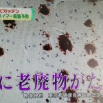 認知症予防は脳のゴミ排除と運動をすること